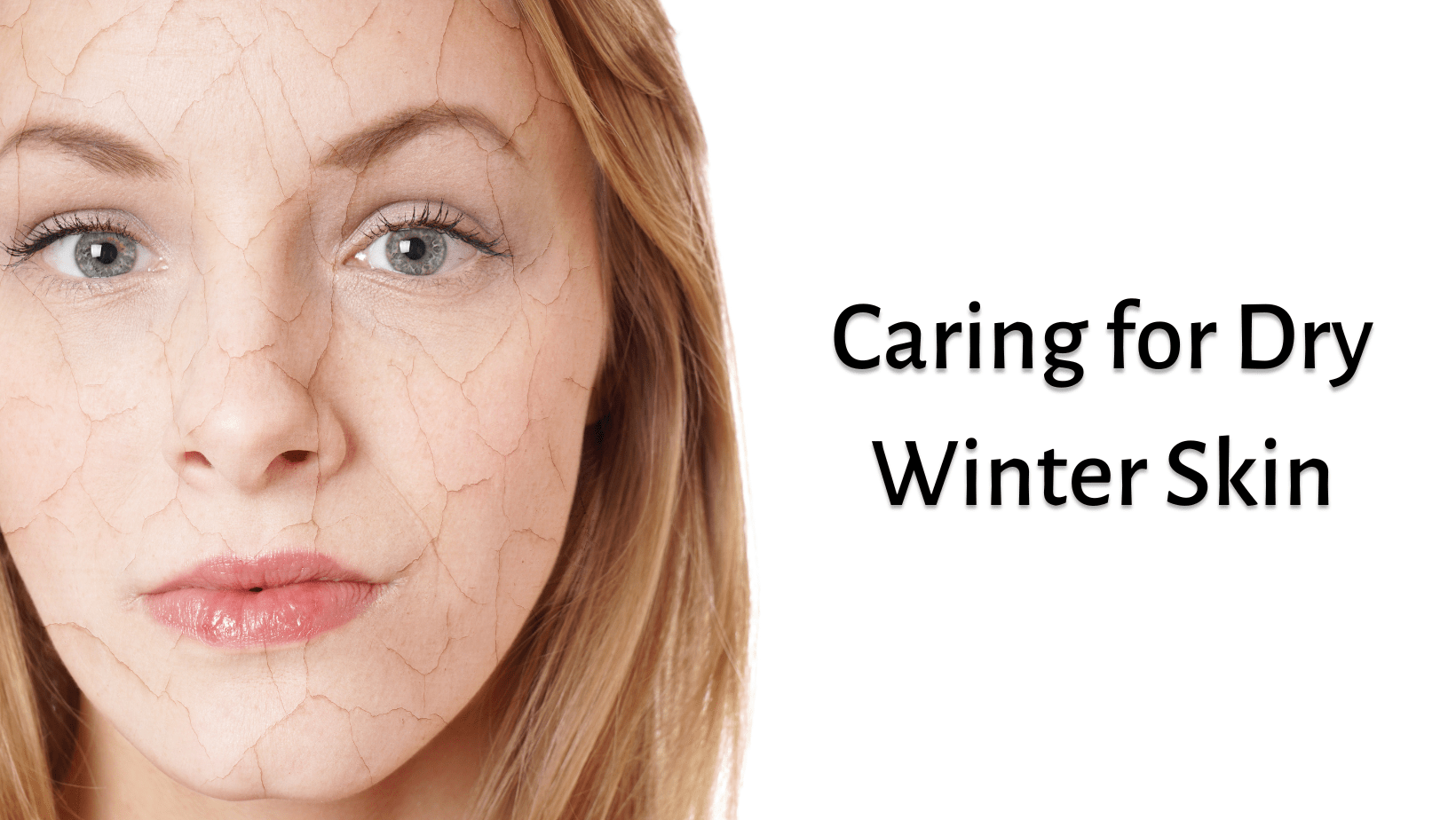 Caring For Dry Winter Skin Ageless Aesthetics And Natural Medicine