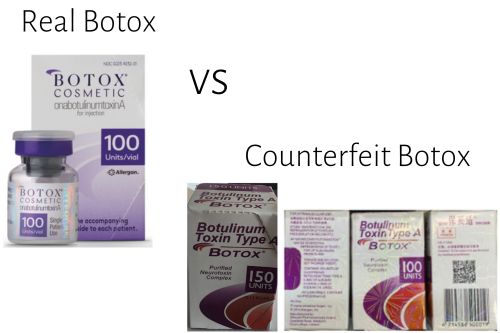 The Dangers of Counterfeit Botox Injections