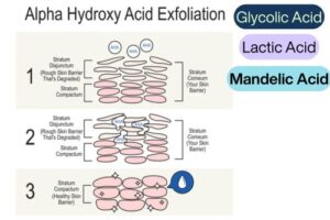 Diagram explaining alpha hydroxy acid exfoliation, its effect on the layers of the skin, and showing three steps of skin barrier improvement. List 3 common alpha hydroxy acids: glycolic, lactic, and mandelic acids.